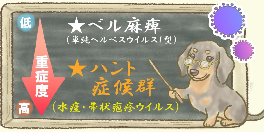 ベル麻痺とハント症候群についての解説図