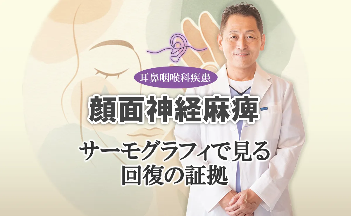 顔面神経麻痺の鍼灸治療の効果はサーモグラフィで確認できる！治療について詳しく解説します