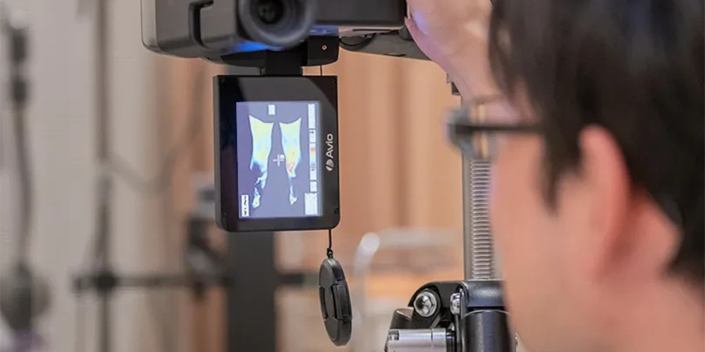 脊髄小脳変性症の方の足部の温度分布を確認する様子